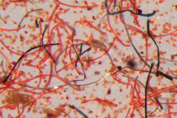 Red microfibers can be seen under a microscope.